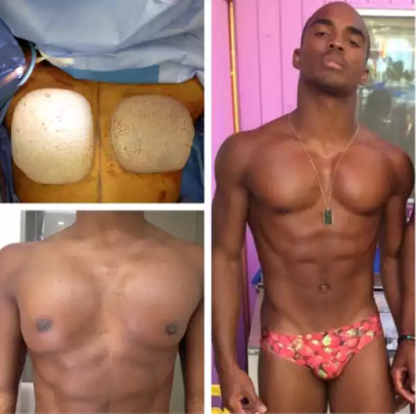 Wait...Guys do chest implants? (Photos)